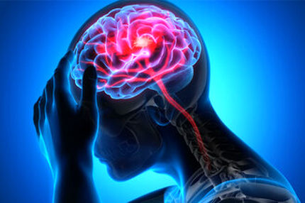 سکته هشداردهنده چیست؟
