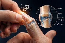 «تق» انگشت‌ها؛ دشمن مفاصل یا یک باور قدیمی